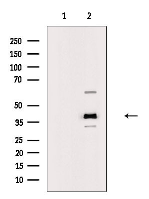 B4GALT5 Antibody in Western Blot (WB)