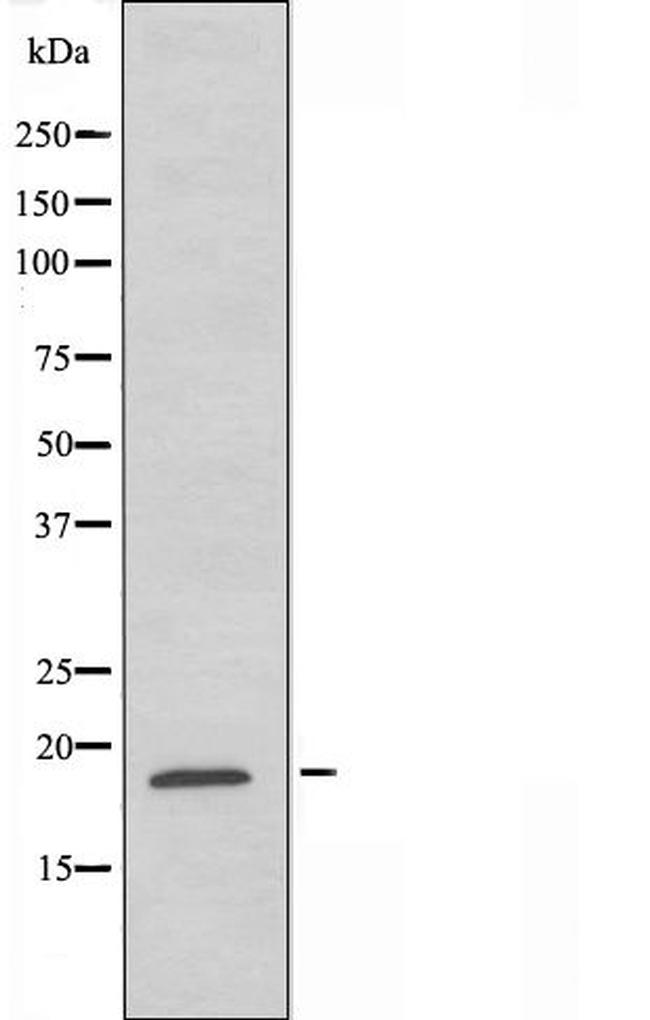 GUSBP1 Antibody in Western Blot (WB)