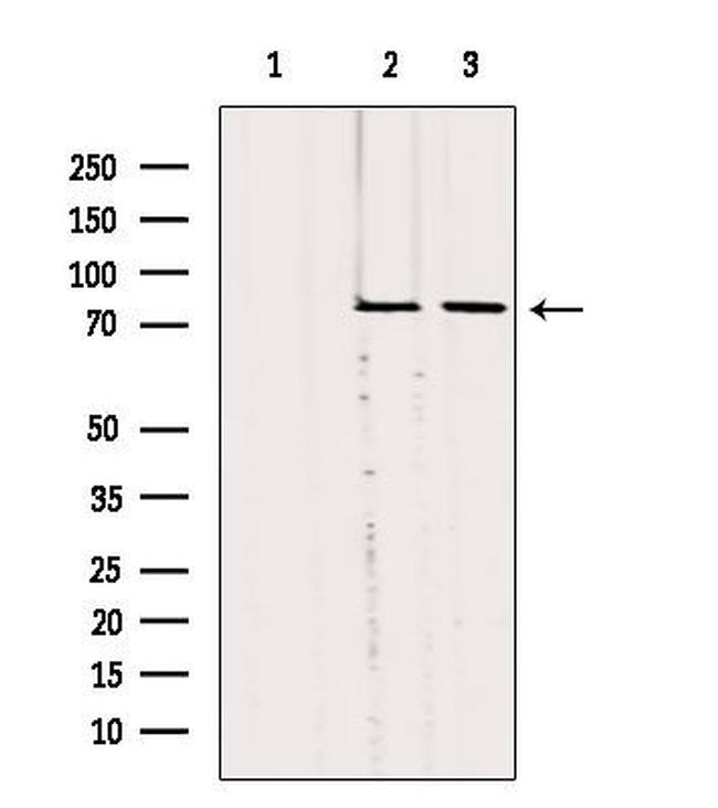 SLC27A5 Antibody in Western Blot (WB)