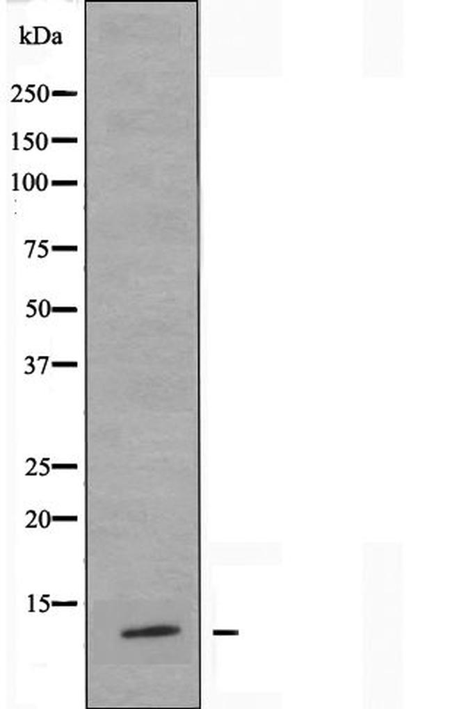 BRP44L Antibody in Western Blot (WB)