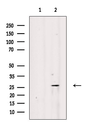 BCAS2 Antibody in Western Blot (WB)