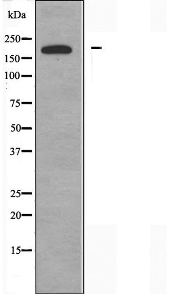 ARFGEF2 Antibody in Western Blot (WB)