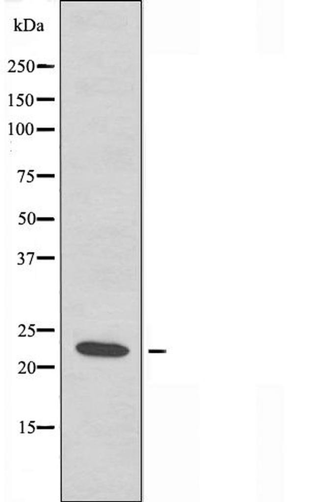 CHP2 Antibody in Western Blot (WB)