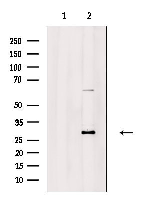 Carbonic Anhydrase I Antibody in Western Blot (WB)