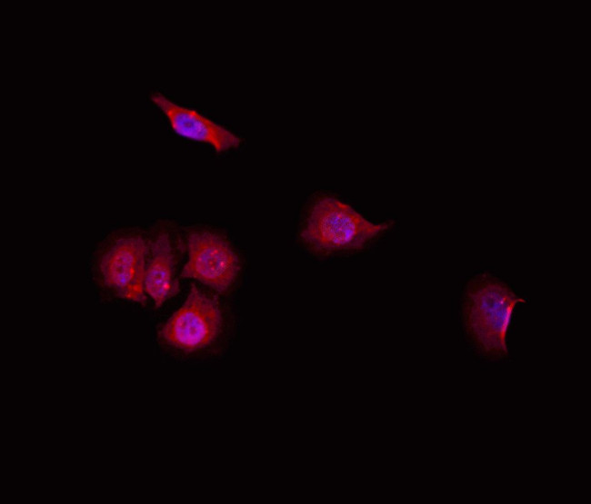 Carboxypeptidase E Antibody in Immunocytochemistry (ICC/IF)