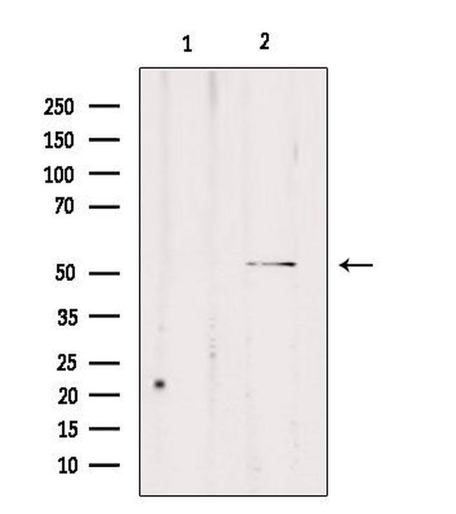 Carboxypeptidase E Antibody in Western Blot (WB)