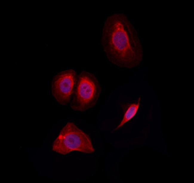 SLC7A4 Antibody in Immunocytochemistry (ICC/IF)