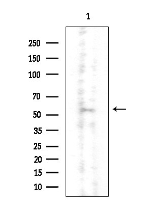 CNOT4 Antibody in Western Blot (WB)