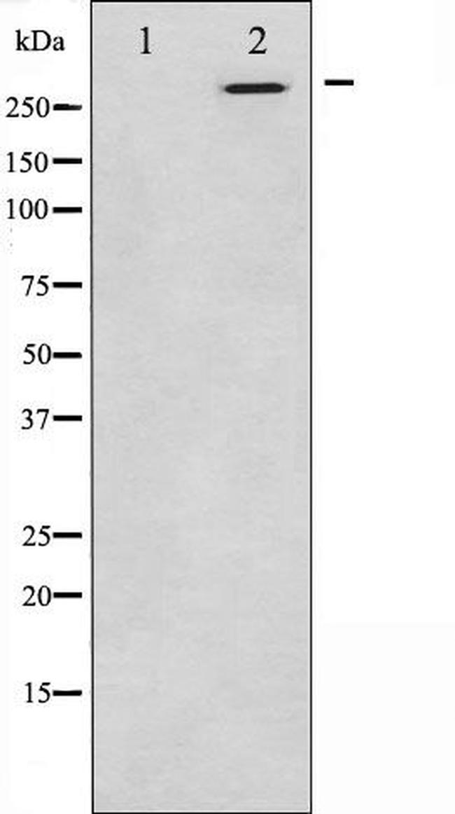 CEP290 Antibody in Western Blot (WB)