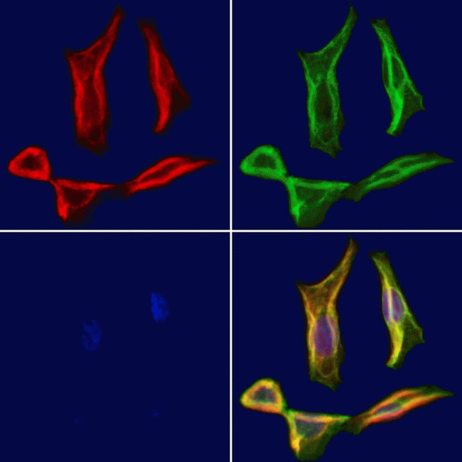 CNGA1 Antibody in Immunocytochemistry (ICC/IF)