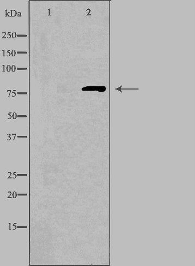 CNGA1 Antibody in Western Blot (WB)