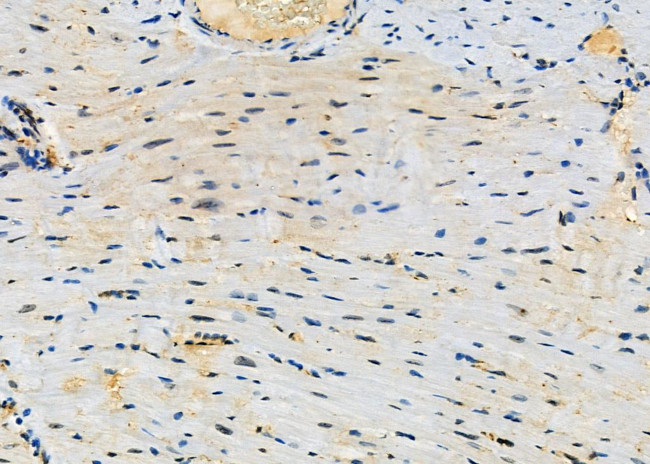 CLCN7 Antibody in Immunohistochemistry (Paraffin) (IHC (P))