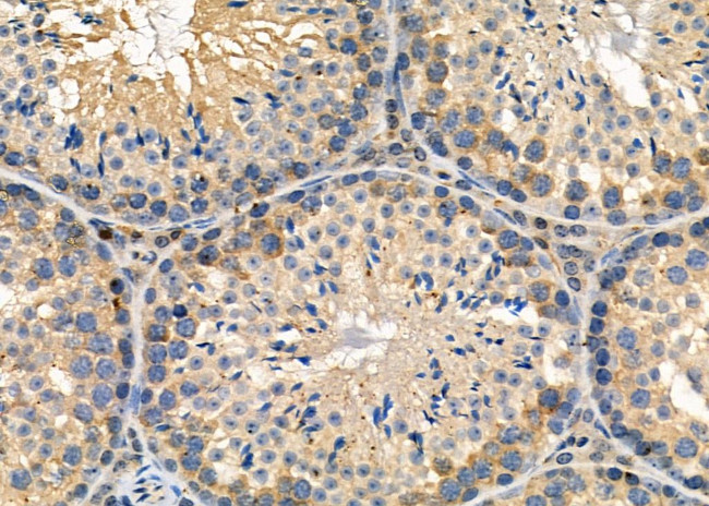 CLCN7 Antibody in Immunohistochemistry (Paraffin) (IHC (P))