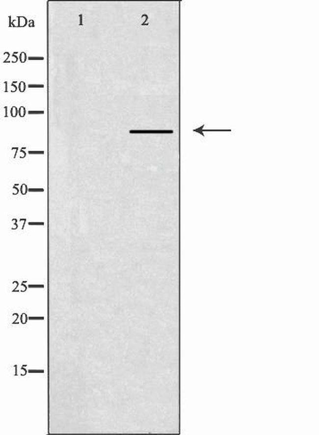 CLCN7 Antibody in Western Blot (WB)