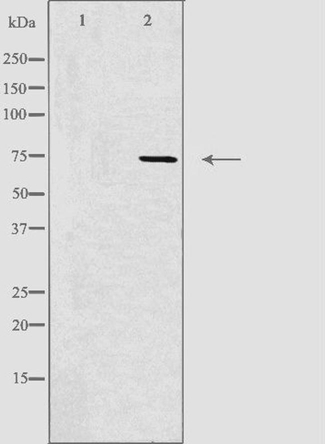 CLIC6 Antibody in Western Blot (WB)