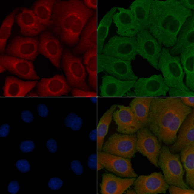 CSGLCAT Antibody in Immunocytochemistry (ICC/IF)