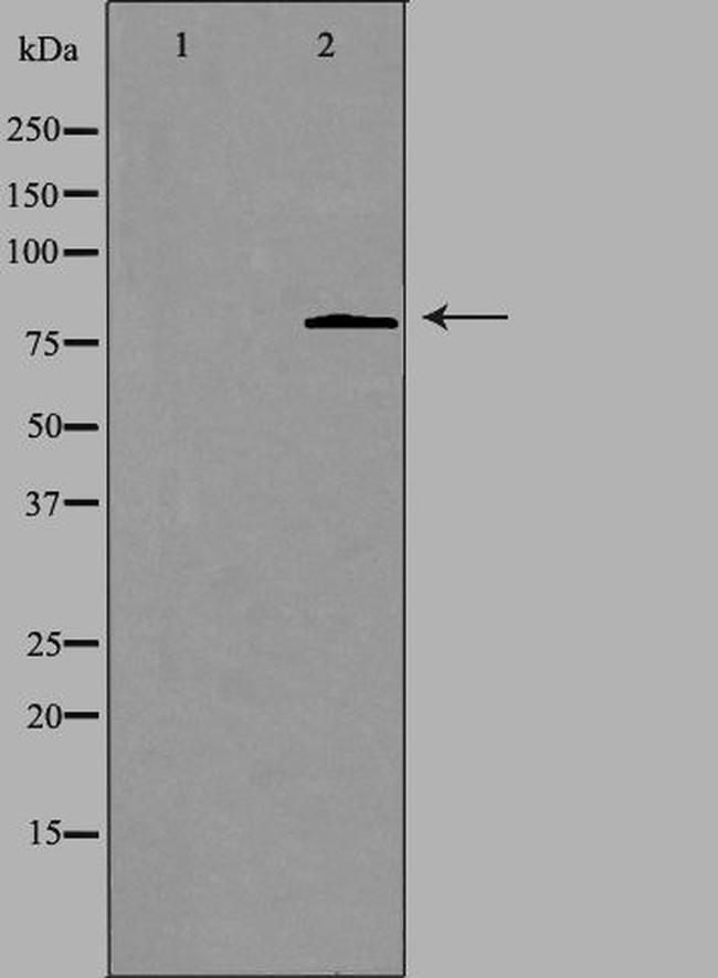 CHPF Antibody in Western Blot (WB)