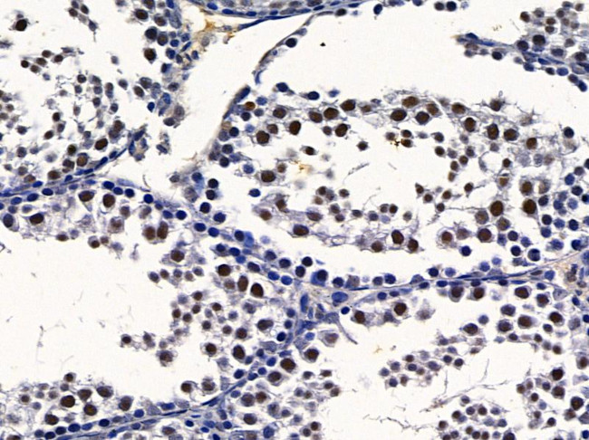 CSTF2T Antibody in Immunohistochemistry (Paraffin) (IHC (P))