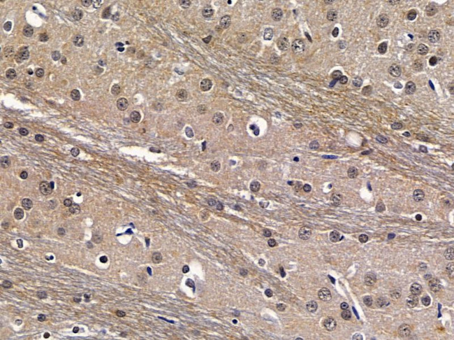 CSTF2T Antibody in Immunohistochemistry (Paraffin) (IHC (P))