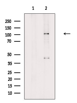 NCAPG Antibody in Western Blot (WB)