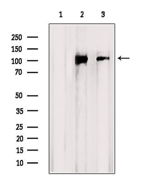 CNGB1 Antibody in Western Blot (WB)