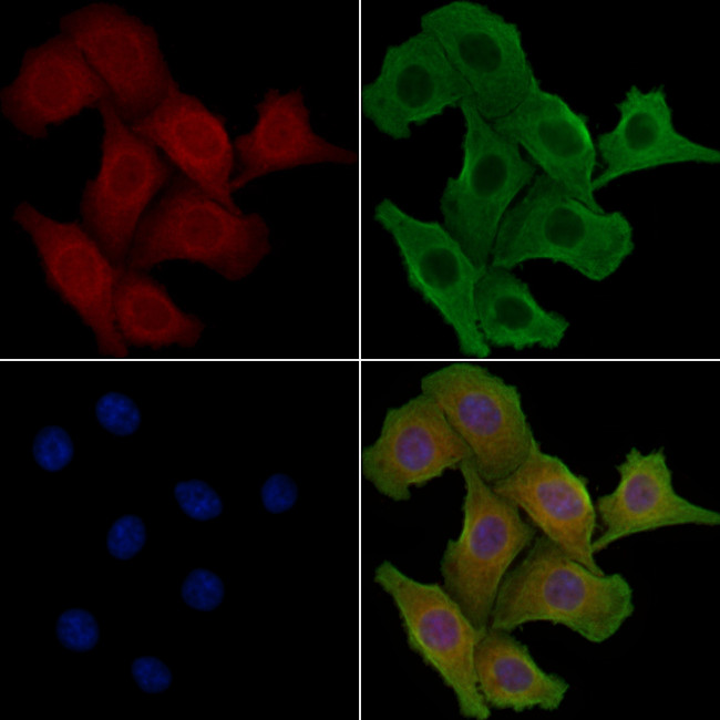 GNPAT Antibody in Immunocytochemistry (ICC/IF)