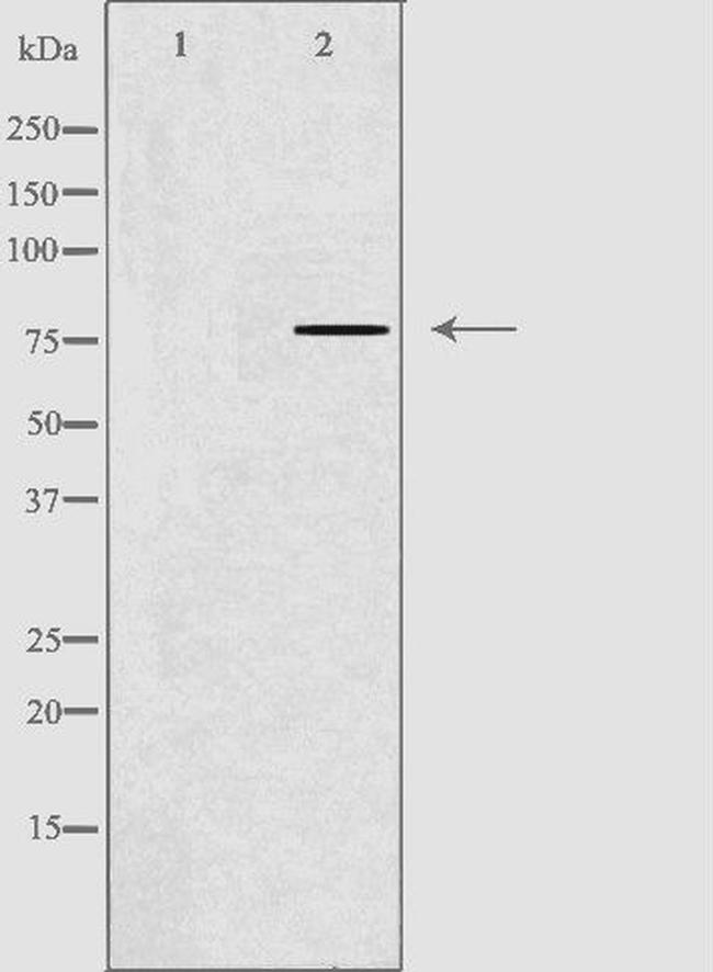 GNPAT Antibody in Western Blot (WB)