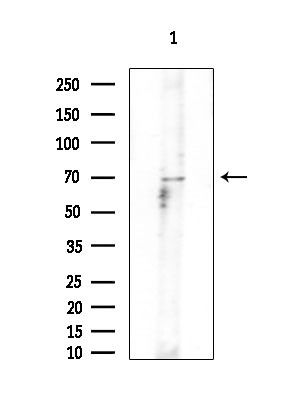 GNPAT Antibody in Western Blot (WB)