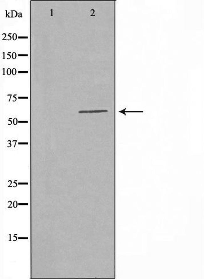 POLR3C Antibody in Western Blot (WB)