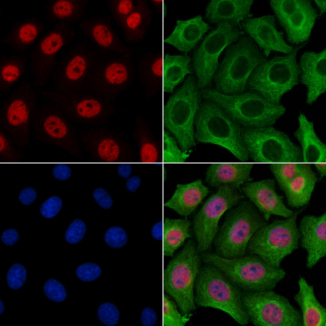 CCNB1IP1 Antibody in Immunocytochemistry (ICC/IF)