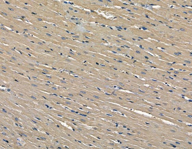 DZIP3 Antibody in Immunohistochemistry (Paraffin) (IHC (P))