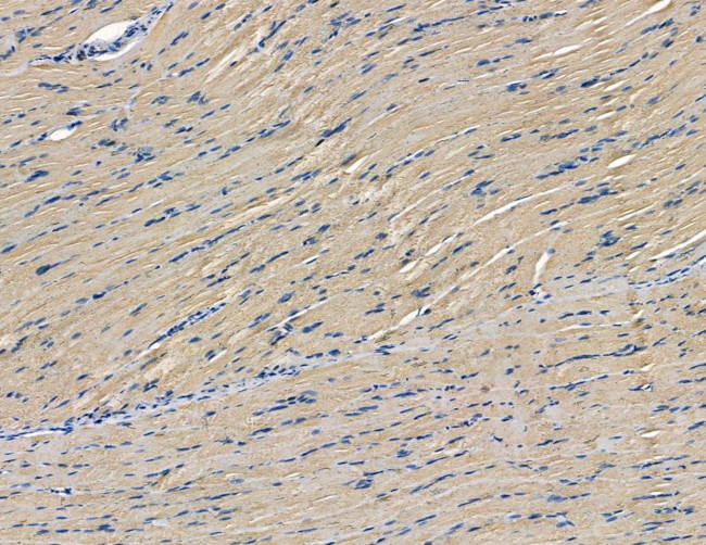 DZIP3 Antibody in Immunohistochemistry (Paraffin) (IHC (P))