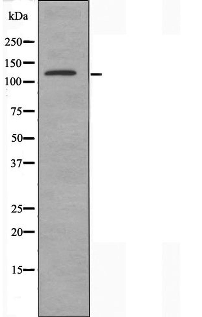 DZIP3 Antibody in Western Blot (WB)