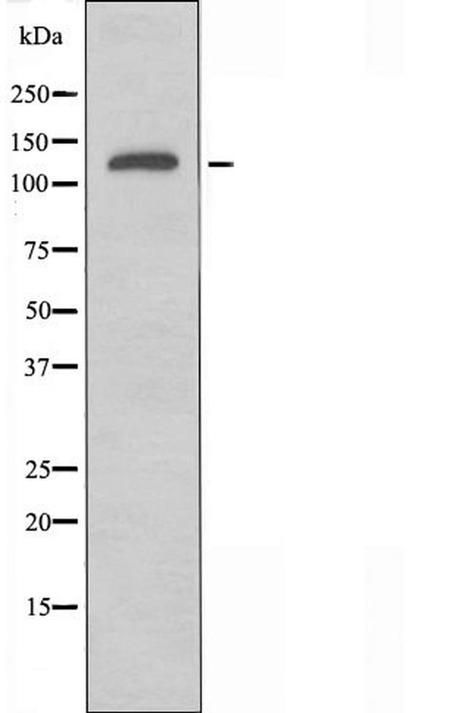 NEDL2 Antibody in Western Blot (WB)