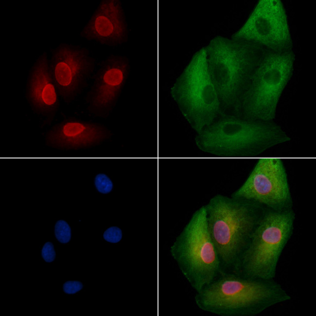 NEIL1 Antibody in Immunocytochemistry (ICC/IF)