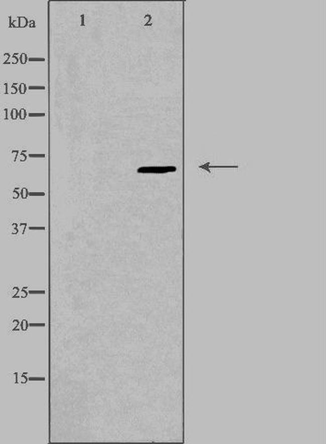 Epsin 2 Antibody in Western Blot (WB)