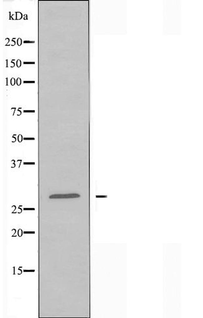 KDELR3 Antibody in Western Blot (WB)