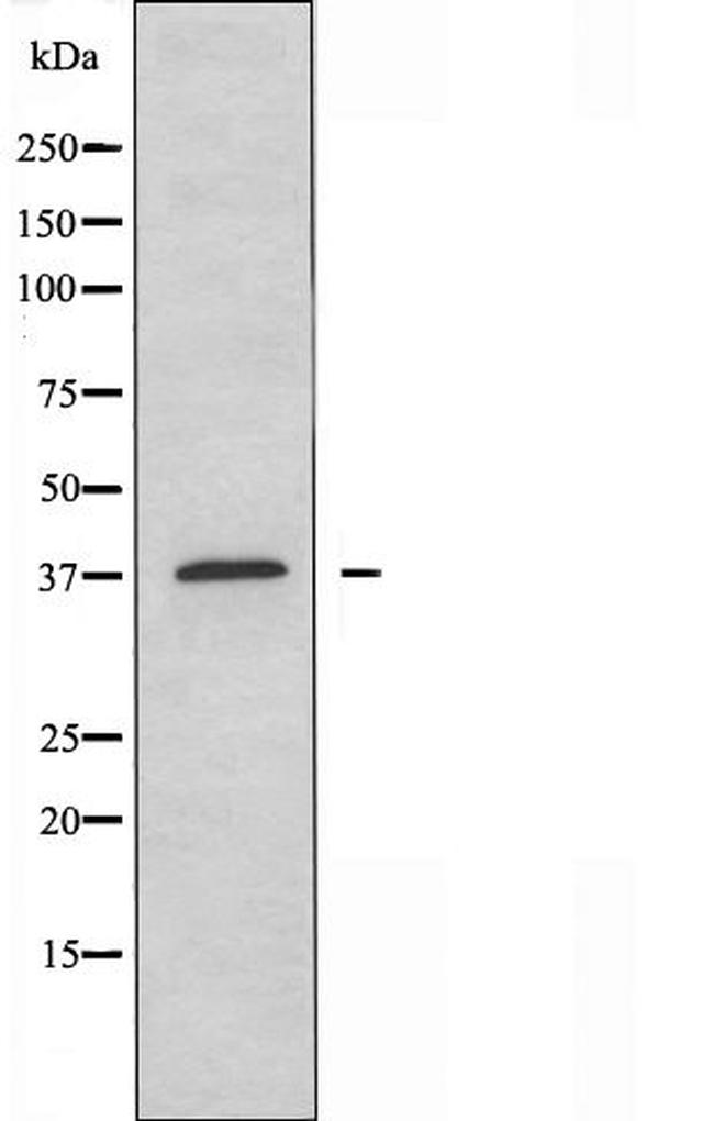 eIF3f Antibody in Western Blot (WB)