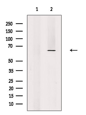 eIF3d Antibody in Western Blot (WB)