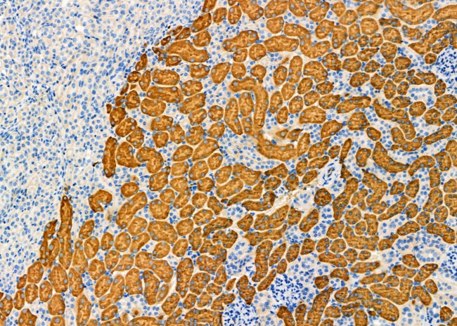 Aldolase B Antibody in Immunohistochemistry (Paraffin) (IHC (P))