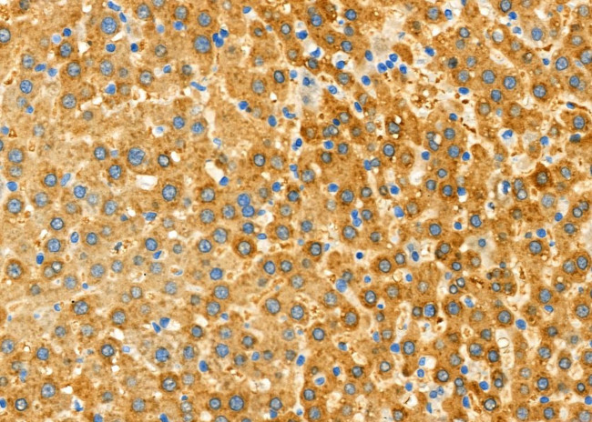 Aldolase B Antibody in Immunohistochemistry (Paraffin) (IHC (P))