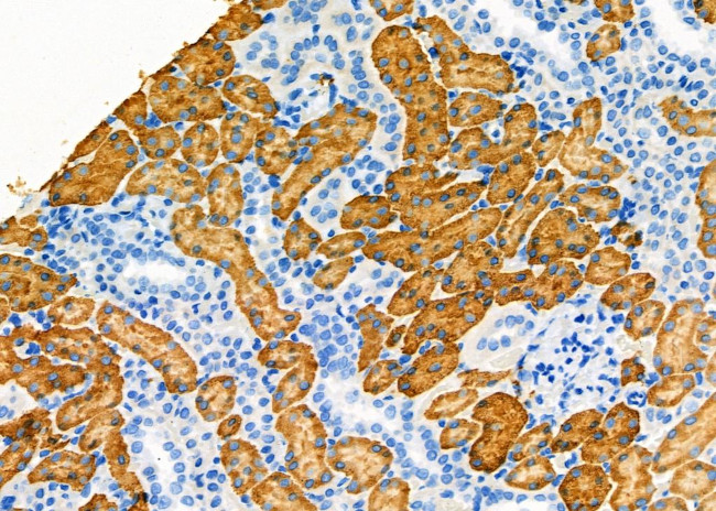 Aldolase B Antibody in Immunohistochemistry (Paraffin) (IHC (P))