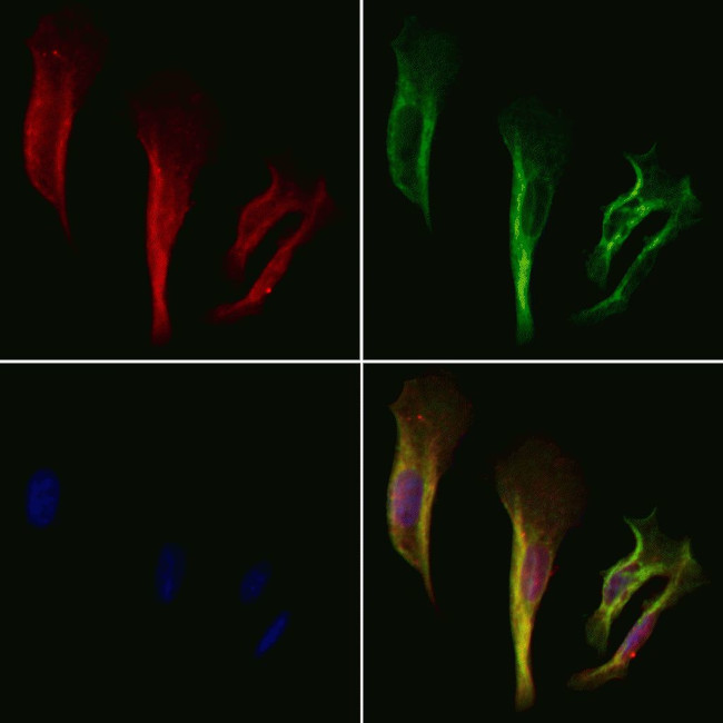 Aldolase B Antibody in Immunocytochemistry (ICC/IF)