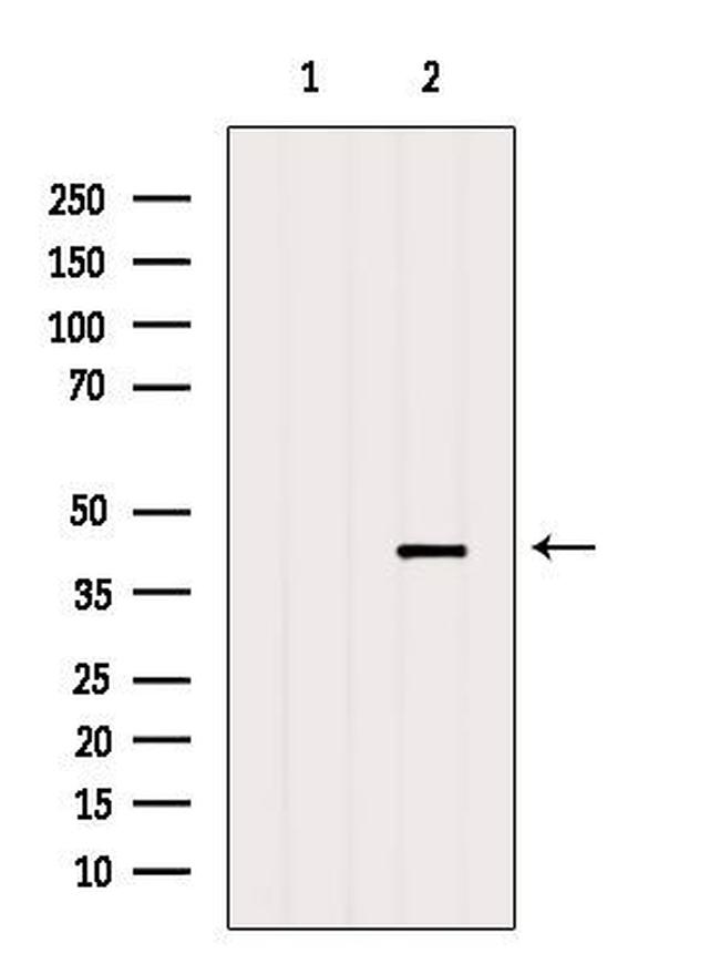 Aldolase B Antibody in Western Blot (WB)