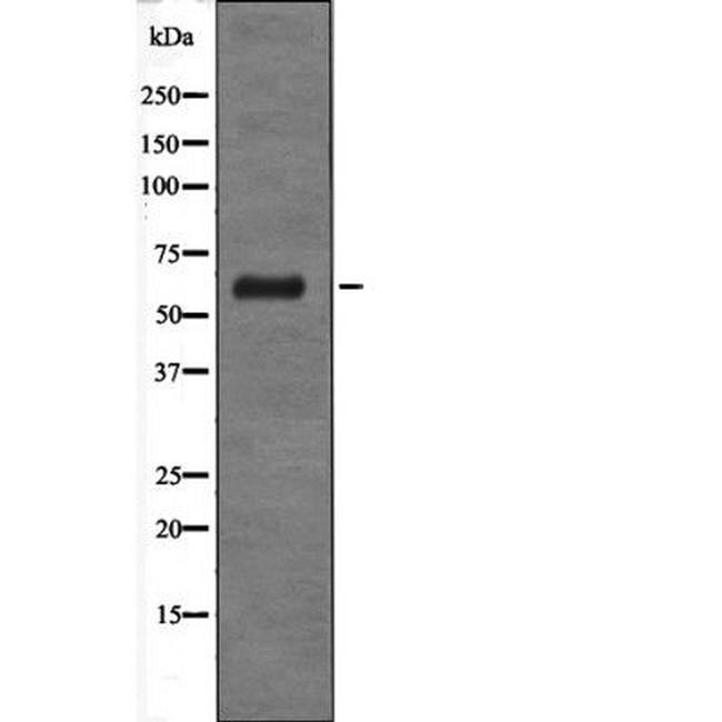 GABRD Antibody in Western Blot (WB)