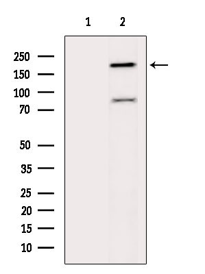 GCP6 Antibody in Western Blot (WB)