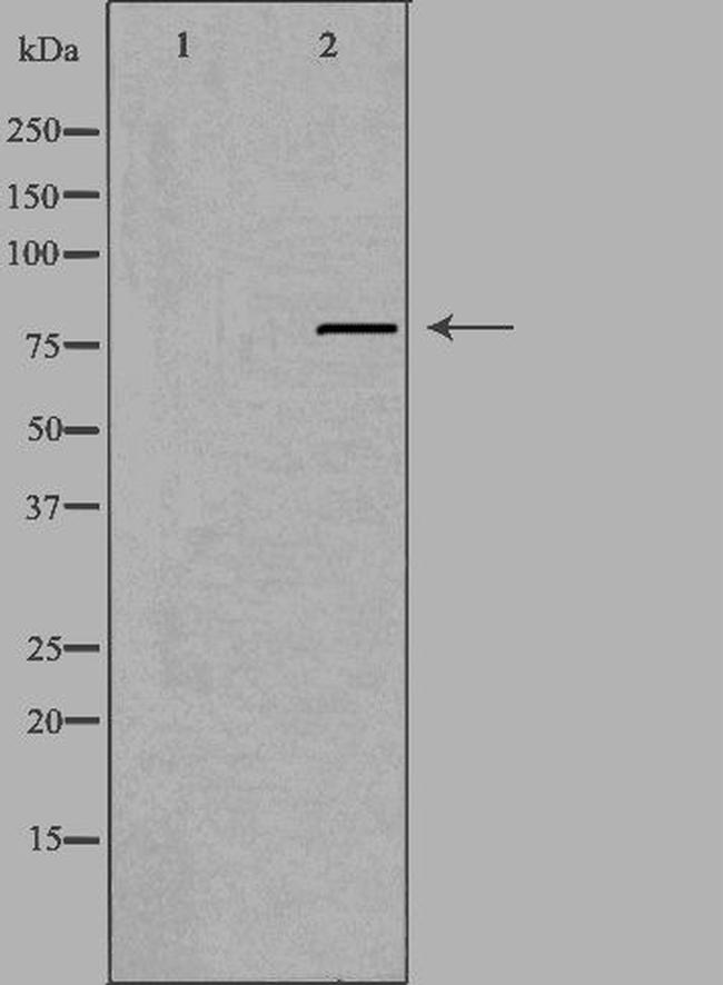 C2orf3 Antibody in Western Blot (WB)