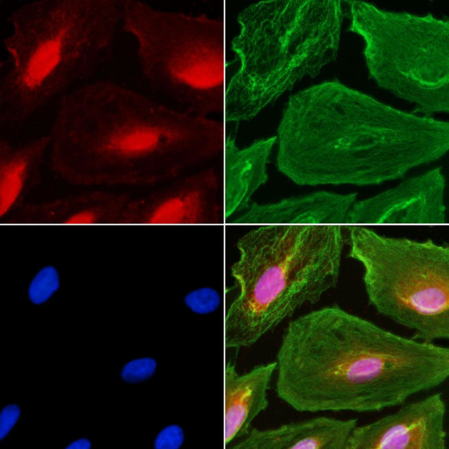 C2orf3 Antibody in Immunocytochemistry (ICC/IF)