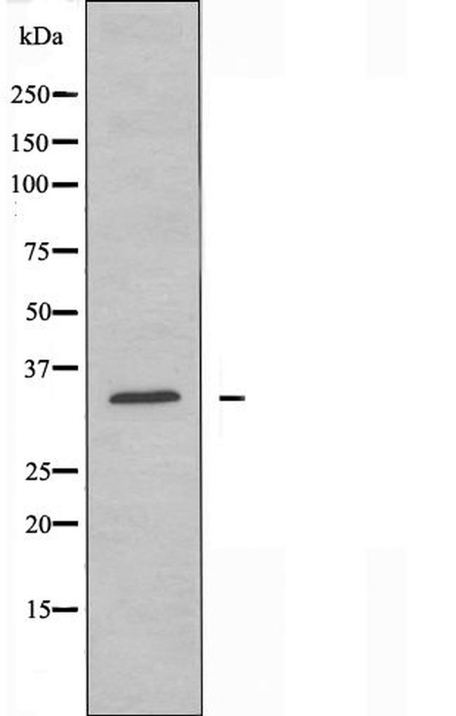 GRTP1 Antibody in Western Blot (WB)