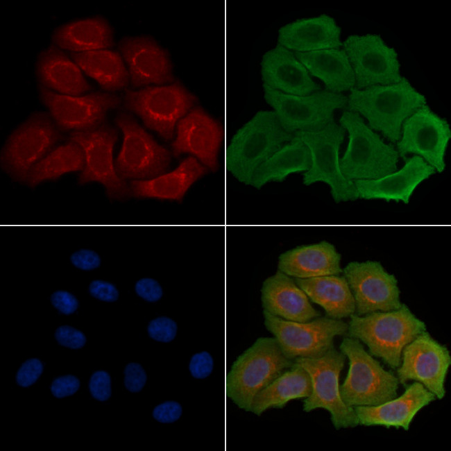 R3HCC1L Antibody in Immunocytochemistry (ICC/IF)